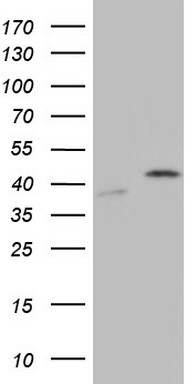 HEK293T cells were transfected with the pCMV6-ENTRY control (Left lane) or pCMV6-ENTRY TFF1 (RC207599, Right lane) cDNA for 48 hrs and lysed. Equivalent amounts of cell lysates (5 ug per lane) were separated by SDS-PAGE and immunoblotted with anti-TFF1. Positive lysates LY418822 (100 ug) and LC418822 (20 ug) can be purchased separately from OriGene.