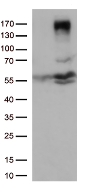 /assets/images/antibody/100/ta804937-1-w.jpg