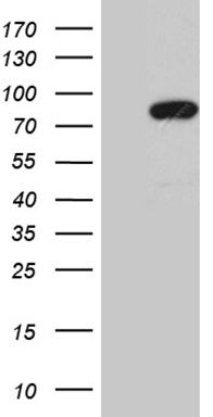 HEK293T cells were transfected with the pCMV6-ENTRY control (Left lane) or pCMV6-ENTRY NR4A3 (RC218250, Right lane) cDNA for 48 hrs and lysed. Equivalent amounts of cell lysates (5 ug per lane) were separated by SDS-PAGE and immunoblotted with anti-NR4A3. Positive lysates LY429326 (100 ug) and LC429326 (20 ug) can be purchased separately from OriGene.