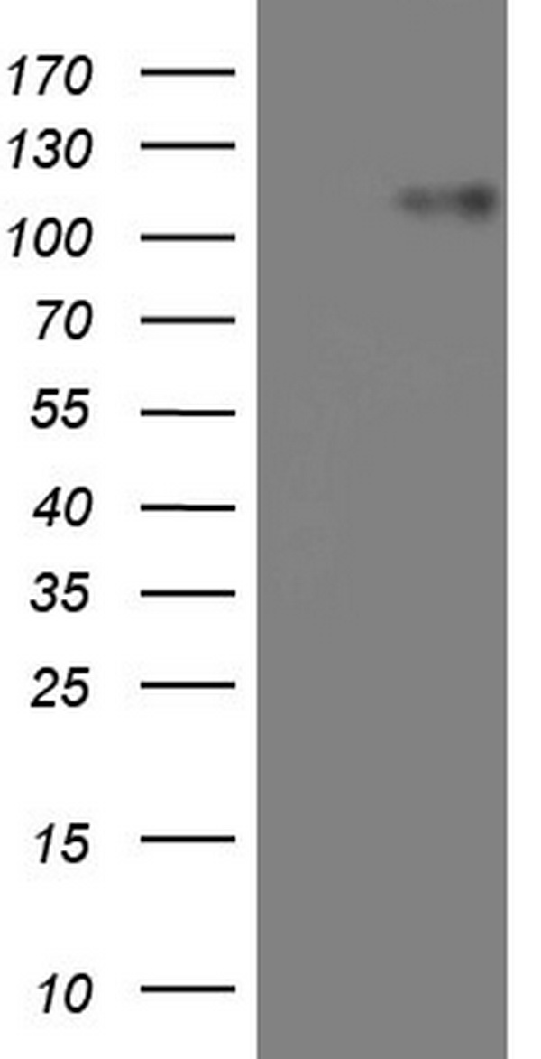 Human recombinant protein fragment corresponding to amino acids 1-303 of human NR5A2 (NP_995582) produced in E.coli.
