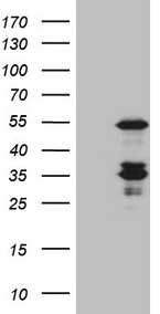 HEK293T cells were transfected with the pCMV6-ENTRY control (Left lane) or pCMV6-ENTRY SENP8 (RC206791, Right lane) cDNA for 48 hrs and lysed. Equivalent amounts of cell lysates (5 ug per lane) were separated by SDS-PAGE and immunoblotted with anti-SENP8 (1:2000). Positive lysates LY407943 (100 ug) and LC407943 (20 ug) can be purchased separately from OriGene.