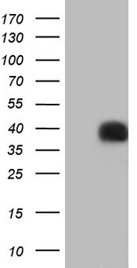 HEK293T cells were transfected with the pCMV6-ENTRY control (Left lane) or pCMV6-ENTRY PAGE1 (RC202446, Right lane) cDNA for 48 hrs and lysed. Equivalent amounts of cell lysates (5 ug per lane) were separated by SDS-PAGE and immunoblotted with anti-PAGE1. Positive lysates LY418433 (100ug) and LC418433 (20ug) can be purchased separately from OriGene.
