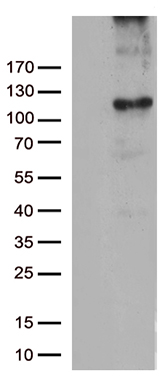 /assets/images/antibody/100/ta805640-1-w.jpg