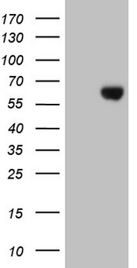 TA326319 (0.1ug/ml) staining of Human (A), Mouse (B) and Rat (C) Heart lysates (35ug protein in RIPA buffer). Primary incubation was 1 hour. Detected by chemiluminescence.