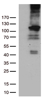 /assets/images/antibody/100/ta805648-1-w.jpg