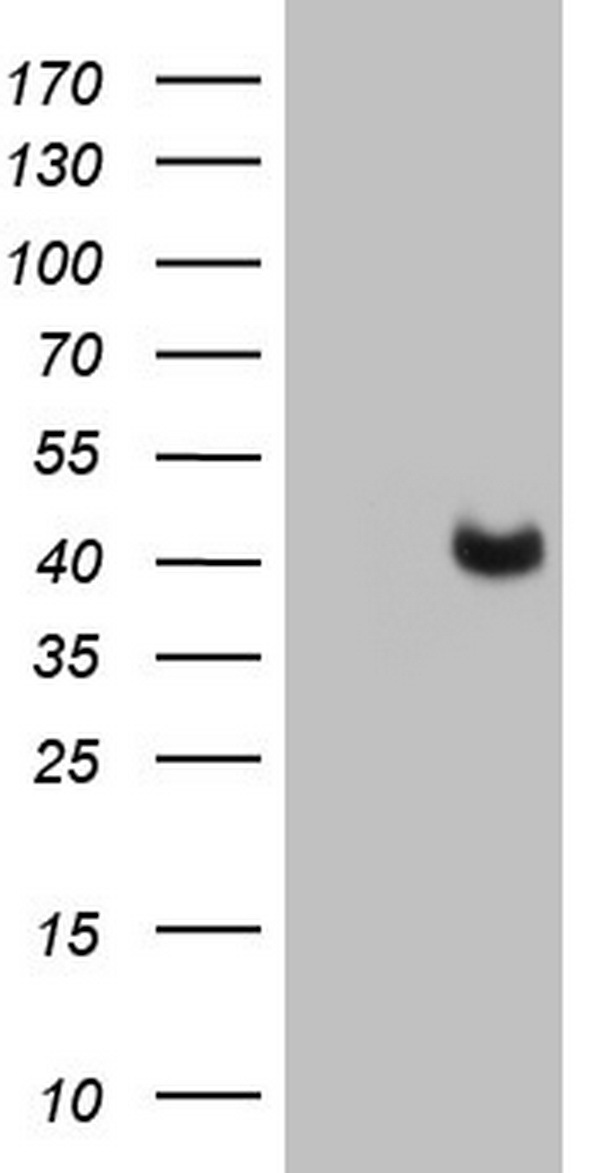 HEK293T cells were transfected with the pCMV6-ENTRY control (Left lane) or pCMV6-ENTRY PAGE1 (RC202446, Right lane) cDNA for 48 hrs and lysed. Equivalent amounts of cell lysates (5 ug per lane) were separated by SDS-PAGE and immunoblotted with anti-PAGE1. Positive lysates LY418433 (100ug) and LC418433 (20ug) can be purchased separately from OriGene.