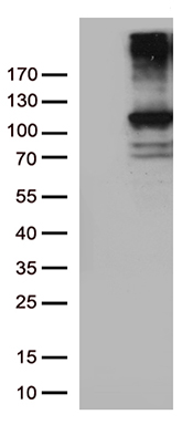 /assets/images/antibody/100/ta805656-1-w.jpg