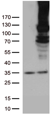 /assets/images/antibody/100/ta805657-1-w.jpg
