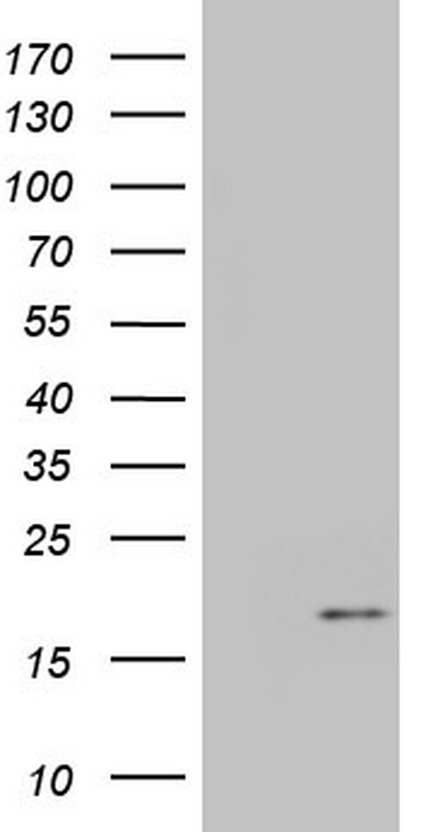 Western blot analysis of ERK1/2 in a human cell line mix, using a 1:1000 dilution of the antibody