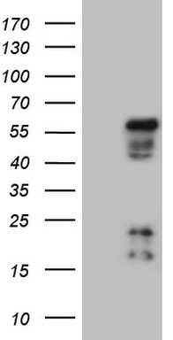 Western blot analysis of extracts of A549 cell and 293 cell line, using ATP1A1 antibody.
