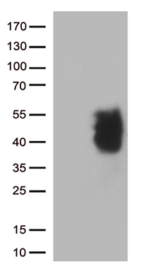 /assets/images/antibody/100/ta806586-1-w.jpg