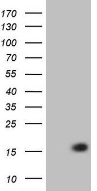 HEK293T cells were transfected with the pCMV6-ENTRY control (Left lane) or pCMV6-ENTRY RARA (RC200430, Right lane) cDNA for 48 hrs and lysed. Equivalent amounts of cell lysates (5 ug per lane) were separated by SDS-PAGE and immunoblotted with anti-RARA. Positive lysates LY400350 (100 ug) and LC400350 (20 ug) can be purchased separately from OriGene.