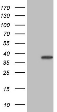 HEK293T cells were transfected with the pCMV6-ENTRY control (Left lane) or pCMV6-ENTRY SYCP3 (RC209340, Right lane) cDNA for 48 hrs and lysed. Equivalent amounts of cell lysates (5 ug per lane) were separated by SDS-PAGE and immunoblotted with anti-SYCP3. Positive lysates LY406978 (100ug) and LC406978 (20ug) can be purchased separately from OriGene.