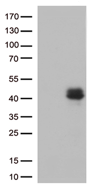 /assets/images/antibody/100/ta806803-1-w.jpg