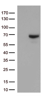 /assets/images/antibody/100/ta806846-1-w.jpg