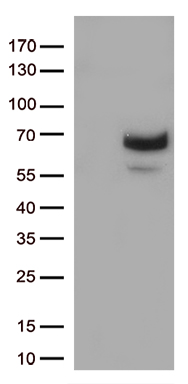 /assets/images/antibody/100/ta806847-1-w.jpg