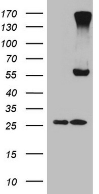 HEK293T cells were transfected with the pCMV6-ENTRY control (Left lane) or pCMV6-ENTRY CD248 (RC208576, Right lane) cDNA for 48 hrs and lysed. Equivalent amounts of cell lysates (5 ug per lane) were separated by SDS-PAGE and immunoblotted with anti-CD248. Positive lysates LY412436 (100 ug) and LC412436 (20 ug) can be purchased separately from OriGene.