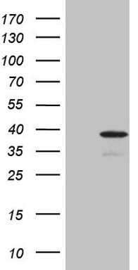 Western blot analysis of extracts of HeLa cell line and H3 protein expressed in E.coli. using TriMethyl-Histone H3-K4 antibody.