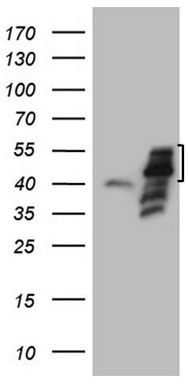 Western blot analysis of extracts of HeLa cell line and H3 protein expressed in E.coli., using MonoMethyl-Histone H3-K9antibody.