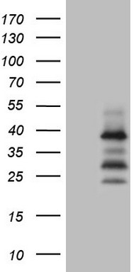 Western blot analysis of extracts of HeLa cell line and H3 protein expressed in E.coli., using DiMethyl-Histone H3-K9 antibody.