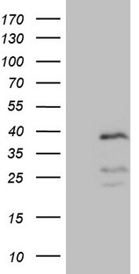 Western blot analysis of extracts of HeLa cell line and H3 protein expressed in E.coli., using H3K27me2 antibody.