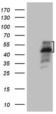 Western blot analysis of extracts of HeLa cell line and H3 protein expressed in E.coli., using TriMethyl-Histone H3-K27 antibody.