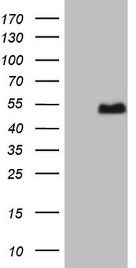 Western blot analysis of extracts of HeLa cell line and H3 protein expressed in E.coli., using H3K36me2 antibody.
