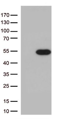 /assets/images/antibody/100/ta807341-1-w.jpg