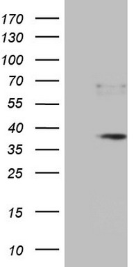 Western blot analysis of extracts of HeLa cell line and H3 protein expressed in E.coli., using DiMethyl-Histone H3-K79 antibody.