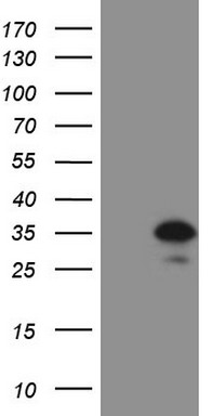 Western blot analysis of extracts of HeLa cell line and H3 protein expressed in E.coli., using H3K79me3 antibody.