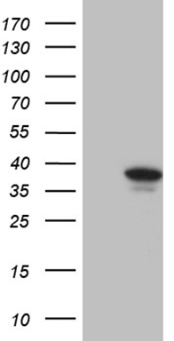 Western blot analysis of extracts of HeLa cell line and H4 protein expressed in E.coli., using H4K20me1 antibody.