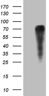 Western blot analysis of extracts of HeLa cell line and H4 protein expressed in E.coli., using H4K20me3 antibody.