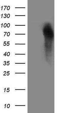 Western blot analysis of extracts of HeLa cell line and H3 protein expressed in E.coli., using H3R2me2s antibody.