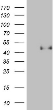 HEK293T cells were transfected with the pCMV6-ENTRY control (Left lane) or pCMV6-ENTRY ESR1 (RC213277, Right lane) cDNA for 48 hrs and lysed. Equivalent amounts of cell lysates (5 ug per lane) were separated by SDS-PAGE and immunoblotted with anti-ESR1 (1:500).