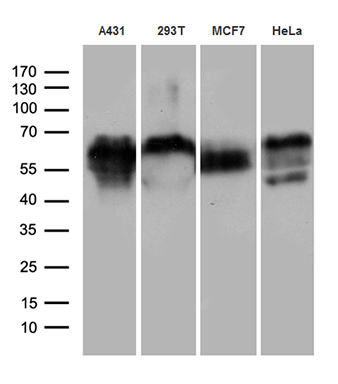 HEK293T cells were transfected with the pCMV6-ENTRY control (Left lane) or pCMV6-ENTRY NR2C2 (RC219184, Right lane) cDNA for 48 hrs and lysed. Equivalent amounts of cell lysates (5 ug per lane) were separated by SDS-PAGE and immunoblotted with anti-NR2C2 (1:2000). Positive lysates LY401137 (100 ug) and LC401137 (20 ug) can be purchased separately from OriGene.