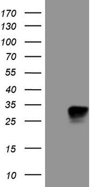 Western blot analysis of extracts of mouse lung, using CDH1 antibody.