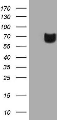 Western blot analysis of extracts of HeLa cell line and H3 protein expressed in E.coli., using Symmetric DiMethyl-Histone H3-R17 antibody.