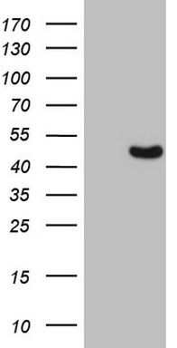 Western blot analysis of extracts of HeLa cell line and H3 protein expressed in E.coli., using H3R8me1 antibody.