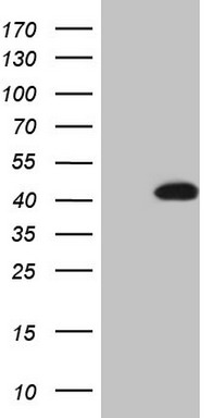 Western blot analysis of extracts of HeLa cell line and H3 protein expressed in E.coli., using Asymmetric DiMethyl-Histone H3-R8 antibody.