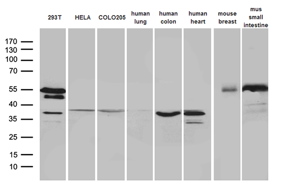 Western blot analysis of extracts of HeLa and H3 protein, using H3K14me2 antibody.