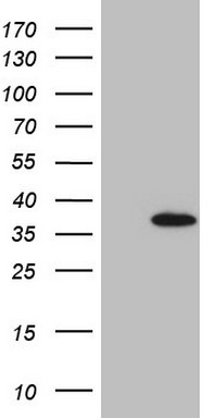 SLC25A25 Antibody (N-term) (Cat. #TA328159) western blot analysis in U-937 cell line and rat cerebellum tissue lysates (35ug/lane).This demonstrates the SLC25A25 antibody detected the SLC25A25 protein (arrow).