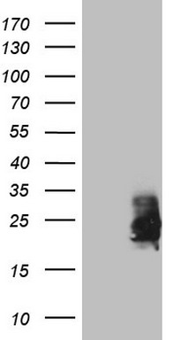 Immunohistochemical staining of paraffin-embedded Human prostate tissue within the normal limits using anti-EGFL7 mouse monoclonal antibody. (Heat-induced epitope retrieval by 1mM EDTA in 10mM Tris buffer (pH8.5) at 120°C for 3min, TA807863) (1:500)