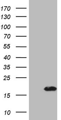 Western blot analysis of rat heart lysate (lanes 1 and 3) and rat liver membrane (lanes 2 and 4): 1, 2. Anti-Two Pore Calcium Channel Protein 1 (extracellular) antibody, (1:200). 3, 4. Anti-Two Pore Calcium Channel Protein 1 (extracellular) antibody, preincubated with the control peptide antigen.