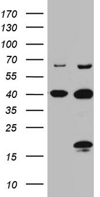 HEK293T cells were transfected with the pCMV6-ENTRY control (Left lane) or pCMV6-ENTRY C4orf36 (RC205468, Right lane) cDNA for 48 hrs and lysed. Equivalent amounts of cell lysates (5 ug per lane) were separated by SDS-PAGE and immunoblotted with anti-C4orf36 (1:2000). Positive lysates LY408187 (100ug) and LC408187 (20ug) can be purchased separately from OriGene.