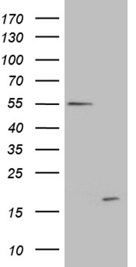 HEK293T cells were transfected with the pCMV6-ENTRY control (Left lane) or pCMV6-ENTRY C4orf36 (RC205468, Right lane) cDNA for 48 hrs and lysed. Equivalent amounts of cell lysates (5 ug per lane) were separated by SDS-PAGE and immunoblotted with anti-C4orf36 (1:500). Positive lysates LY408187 (100ug) and LC408187 (20ug) can be purchased separately from OriGene.