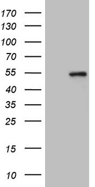 HEK293T cells were transfected with the pCMV6-ENTRY control (Left lane) or pCMV6-ENTRY GNA15 (RC202243, Right lane) cDNA for 48 hrs and lysed. Equivalent amounts of cell lysates (5 ug per lane) were separated by SDS-PAGE and immunoblotted with anti-GNA15 (1:500). Positive lysates LY419560 (100 ug) and LC419560 (20 ug) can be purchased separately from OriGene.