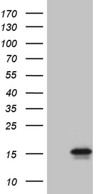 HEK293T cells were transfected with the pCMV6-ENTRY control (Left lane) or pCMV6-ENTRY C4orf36 (RC205468, Right lane) cDNA for 48 hrs and lysed. Equivalent amounts of cell lysates (5 ug per lane) were separated by SDS-PAGE and immunoblotted with anti-C4orf36 (1:2000). Positive lysates LY408187 (100ug) and LC408187 (20ug) can be purchased separately from OriGene.