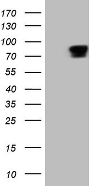 HEK293T cells were transfected with the pCMV6-ENTRY control (Left lane) or pCMV6-ENTRY RGL2 (RC207582, Right lane) cDNA for 48 hrs and lysed. Equivalent amounts of cell lysates (5 ug per lane) were separated by SDS-PAGE and immunoblotted with anti-RGL2 (1:2000). Positive lysates LY417774 (100ug) and LC417774 (20ug) can be purchased separately from OriGene.