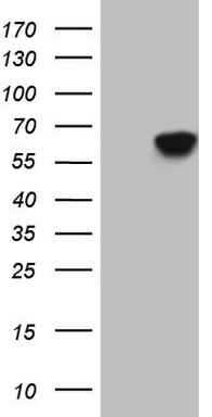 HEK293T cells were transfected with the pCMV6-ENTRY control (Left lane) or pCMV6-ENTRY TCAP (RC203158, Right lane) cDNA for 48 hrs and lysed. Equivalent amounts of cell lysates (5 ug per lane) were separated by SDS-PAGE and immunoblotted with anti-TCAP (1:2000). Positive lysates LY401215 (100 ug) and LC401215 (20 ug) can be purchased separately from OriGene.