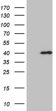 HEK293T cells were transfected with the pCMV6-ENTRY control (Left lane) or pCMV6-ENTRY SRSF9 (RC210898, Right lane) cDNA for 48 hrs and lysed. Equivalent amounts of cell lysates (5 ug per lane) were separated by SDS-PAGE and immunoblotted with anti-SRSF9 (1:2000). Positive lysates LY418444 (100 ug) and LC418444 (20 ug) can be purchased separately from OriGene.
